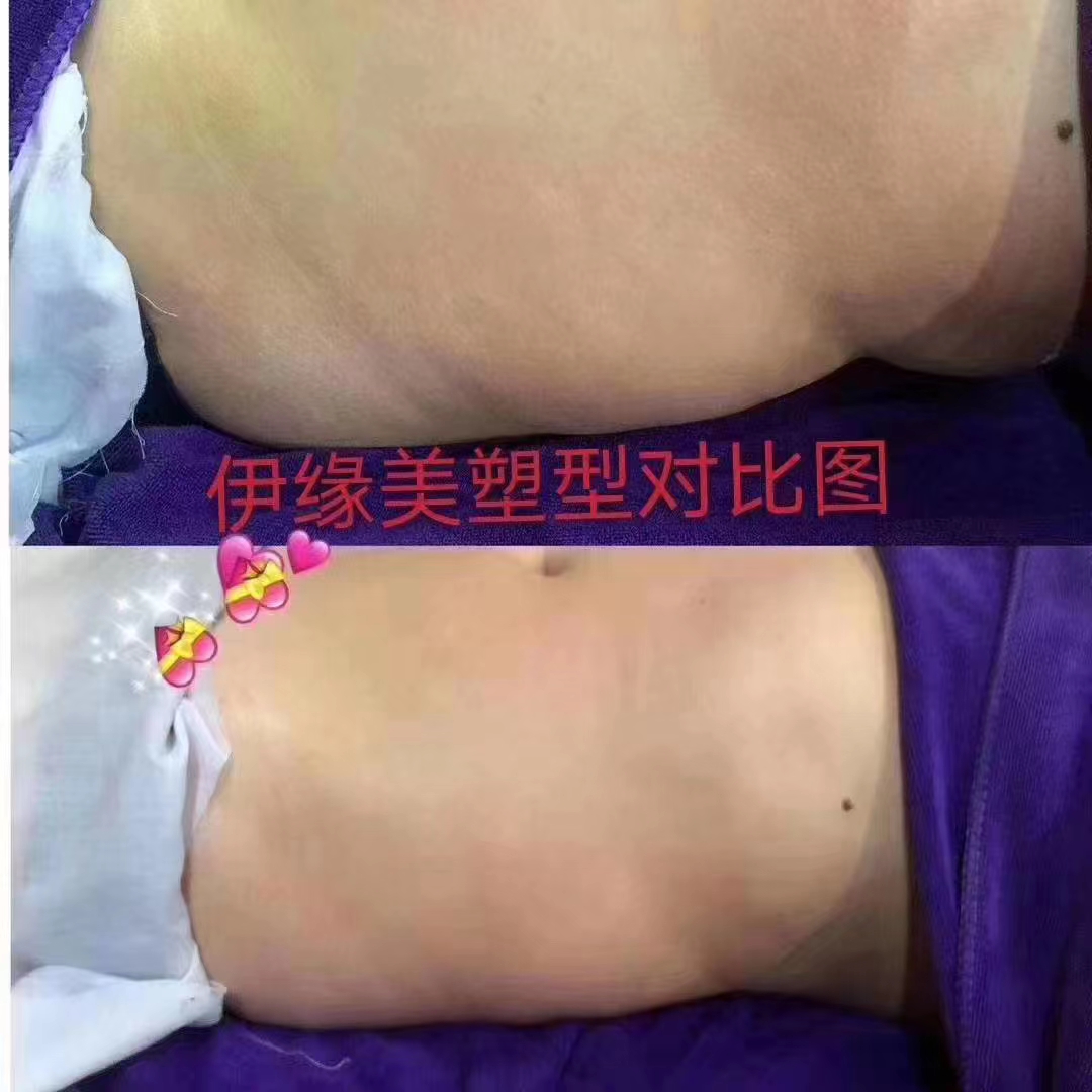 67d3cccc2199f.jpg 67d3cccc2199f.jpg